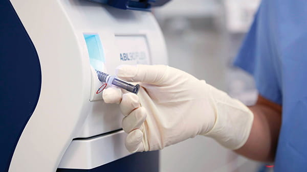 Homogeneización automática en el analizador ABL90 FLEX PLUS